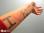 i-heart-rmtv-arm-1